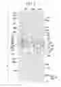 Fig. 03 - Liquid crystal display