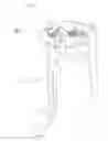 Fig. 01 - STRUCTURE FOR REDUCING CLUTCH PEDAL EFFORT