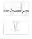 Fig. 03 - Switch operating device, mobile device and method for operating a switch by a non-tactile push-gesture