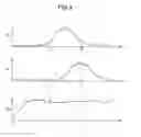 Fig. 04 - Touch panel having a filter unit for filtering unintended touches and method thereof