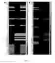 Fig. 07 - IN SILICO METHOD TO IDENTIFY THE IMPORTANT BIOMARKERS AND COMBINATORIAL ONCOPROTEINS IN TARGET BASED CANCER THERAPY
