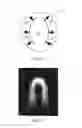 Fig. 03 - Automatic segmentation of hair in images