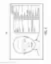 Fig. 04 - 3D patient interface device selection system and method