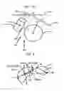 Fig. 09 - Medical image processing apparatus