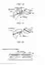 Fig. 11 - Medical image processing apparatus