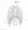 Fig. 04 - Medical image processing apparatus and medical image registration method using virtual reference point for registering images