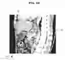 Fig. 11 - Medical image processing apparatus and medical image registration method using virtual reference point for registering images