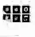 Fig. 07 - Textural analysis of lung nodules