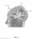 Fig. 05 - Method, system and apparatus for displaying surgical engagement paths