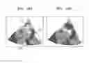 Fig. 17 - Volume rendering apparatus and method using voxel brightness gain values and voxel selecting model