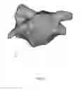 Fig. 04 - Differential mapping of a body organ