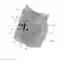 Fig. 10 - Differential mapping of a body organ