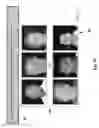 Fig. 82 - Neuroplasticity games for addiction