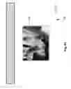 Fig. 84 - Neuroplasticity games for addiction