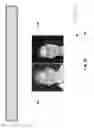 Fig. 92 - Neuroplasticity games for addiction