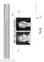 Fig. 100 - Neuroplasticity games