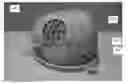 Fig. 01 - SURGICAL TRAINING AND IMAGING BRAIN PHANTOM