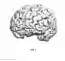 Fig. 07 - SURGICAL TRAINING AND IMAGING BRAIN PHANTOM