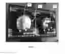Fig. 09 - SURGICAL TRAINING AND IMAGING BRAIN PHANTOM