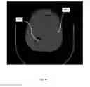Fig. 10 - SURGICAL TRAINING AND IMAGING BRAIN PHANTOM