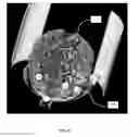 Fig. 11 - SURGICAL TRAINING AND IMAGING BRAIN PHANTOM