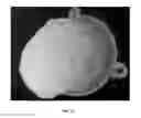 Fig. 13 - SURGICAL TRAINING AND IMAGING BRAIN PHANTOM