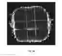Fig. 14 - SURGICAL TRAINING AND IMAGING BRAIN PHANTOM