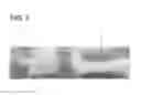 Fig. 03 - Braided conductor