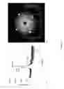 Fig. 05 - Superconducting article with compliant layers