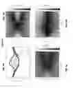 Fig. 07 - Nanogaps on atomically thin materials as non-volatile read/writable memory devices
