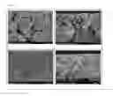 Fig. 02 - Fabricating method of lithium electrode and lithium secondary battery including the same