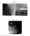 Fig. 07 - POSITIVE ELECTRODE, LITHIUM BATTERY INCLUDING THE SAME, AND METHOD OF MANUFACTURING THE POSITIVE ELECTRODE