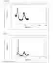 Fig. 07 - Nickel-manganese composite oxyhydroxide, its production method, and its application