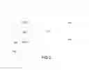 Fig. 03 - Method for operating a communication device in a communication network, a communication device, a luminaire equipped with such communication device