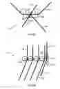 Fig. 04 - Suspension system for supporting and moving equipment