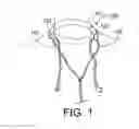 Fig. 02 - EARPHONE CORD MANAGEMENT STRAP