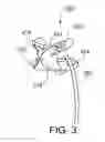 Fig. 04 - EARPHONE CORD MANAGEMENT STRAP