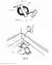 Fig. 03 - WIRE COIL RETAINER