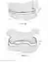 Fig. 13 - WIRE COIL RETAINER