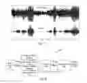 Fig. 08 - Hearing-aid noise reduction circuitry with neural feedback to improve speech comprehension