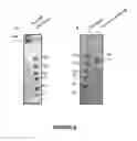 Fig. 14 - Transgenic non-human mammal for producing chimeric human immunoglobulin E antibodies