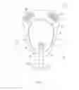 Fig. 03 - Species specific extermination device