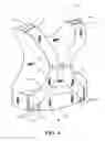Fig. 04 - BREAST SUPPORT