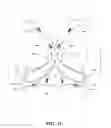 Fig. 15 - BREAST SUPPORT