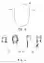 Fig. 03 - Hat with attachable and interchangeable hairpiece