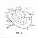 Fig. 02 - Protective headgear