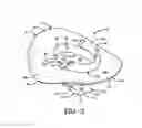 Fig. 03 - Protective headgear