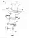 Fig. 07 - ADJUSTABLE SPINAL SUPPORT APPARATUS, SYSTEM, AND DEVICE