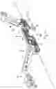 Fig. 05 - Support Device Adjustable by an Electric Motor