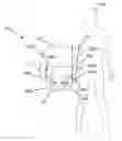 Fig. 01 - CARRIER SUPPORT SYSTEM